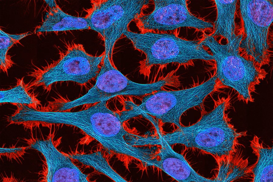 Gene Therapy 01 press 0 jpeg