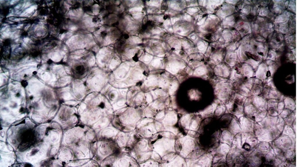 Senescent cells: Microscopic image showing a dense layer of cells with varied shapes and dark-stained areas