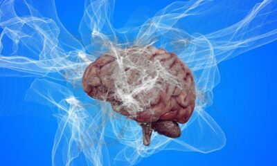 Human brain surrounded by abstract white neural structures, illustrating research into the separate developmental origins of brain cells.